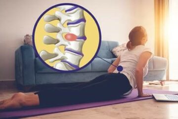 Slipped Disc Treatment